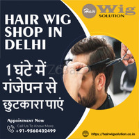 Hair Wig Shop, Hair Replacement Service in Delhi